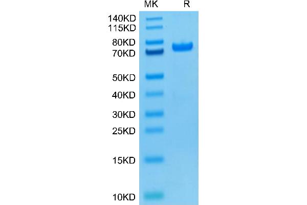 PAD4 Protein (AA 1-663) (His tag,Biotin)