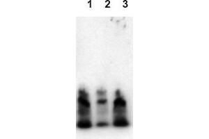 Western Blotting (WB) image for anti-Amyloid beta (Abeta) (N-Term) antibody (ABIN126730) (beta Amyloid 抗体  (N-Term))