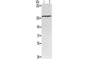 Gel: 6 % SDS-PAGE, Lysate: 40 μg, Lane 1-2: Hela cells, hepg2 cells, Primary antibody: ABIN7130874(RGS22 Antibody) at dilution 1/400, Secondary antibody: Goat anti rabbit IgG at 1/8000 dilution, Exposure time: 20 seconds (RGS22 抗体)