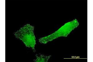 Immunofluorescence of monoclonal antibody to SH2D3C on HeLa cell. (SH2D3C 抗体  (AA 1-110))