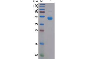 Human CD Protein, hFc Tag on SDS-PAGE under reducing condition. (CLEC2D Protein (Fc Tag))