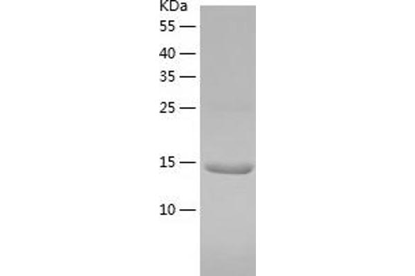 TRIM24 Protein (AA 896-1014) (His tag)