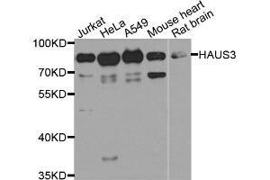 Western blot analysis of extracts of various cell lines, using HAUS3 antibody (ABIN5974538) at 1/1000 dilution. (HAUS3 抗体)