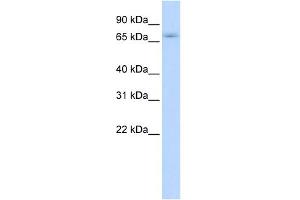 WB Suggested Anti-ZNF708 Antibody Titration:  0. (ZNF708 抗体  (N-Term))