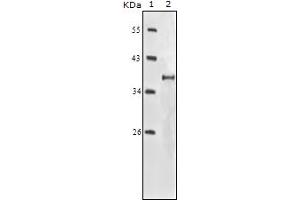 Western Blotting (WB) image for anti-Insulin-Like Growth Factor 1 Receptor (IGF1R) (truncated) antibody (ABIN2464067) (IGF1R 抗体  (truncated))