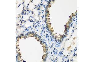 Immunohistochemistry of paraffin-embedded mouse lung using CYP2F1 antibody (ABIN5974739) at dilution of 1/200 (40x lens). (CYP2F1 抗体)