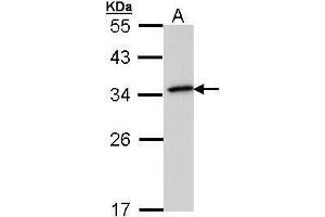 WB Image Sample (30 ug of whole cell lysate) A: 293T 12% SDS PAGE antibody diluted at 1:1000 (NQO1 抗体  (Center))