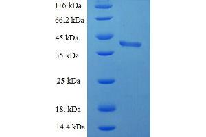 SDS-PAGE (SDS) image for BH3 Interacting Domain Death Agonist (BID) (AA 1-195), (full length) protein (His-SUMO Tag) (ABIN5709137) (BID Protein (AA 1-195, full length) (His-SUMO Tag))