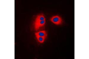 Immunofluorescent analysis of MRPL32 staining in HepG2 cells. (MRPL32 抗体  (Center))