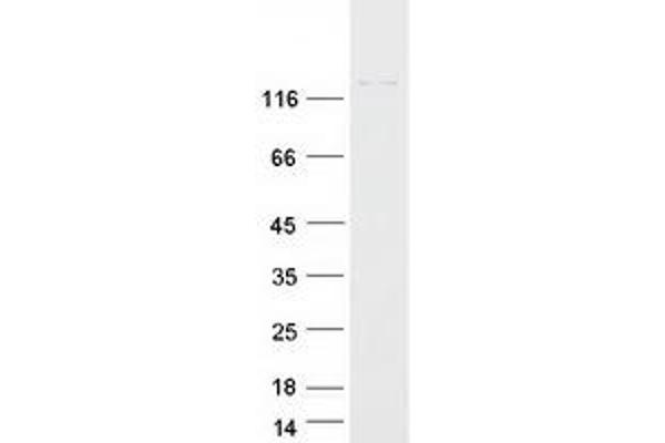 CHAF1A Protein (Myc-DYKDDDDK Tag)