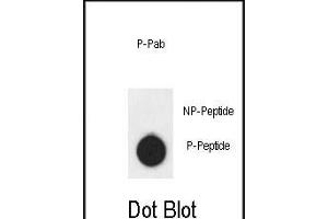 Dot blot analysis of anti-AKT1- Phospho-specific Pab (ABIN6241037 and ABIN6578932) on nitrocellulose membrane. (AKT1 抗体  (pSer124))