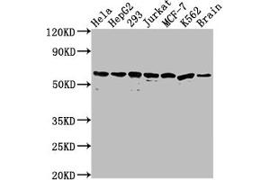 Western Blotting (WB) image for anti-Heat Shock 60kDa Protein 1 (Chaperonin) (HSPD1) antibody (ABIN7127551)