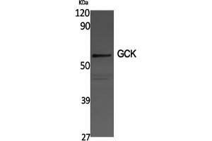Western Blotting (WB) image for anti-Glucokinase (Hexokinase 4) (GCK) antibody (ABIN5961047) (GCK 抗体)