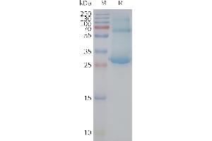 SDS-PAGE (SDS) image for ADGRE5 protein (ABIN7491535)