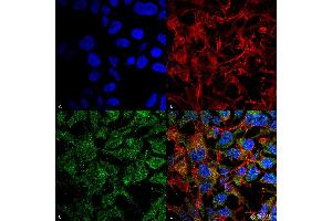 Immunocytochemistry/Immunofluorescence analysis using Rabbit Anti-BDNF Polyclonal Antibody . (BDNF 抗体  (N-Term) (PerCP))