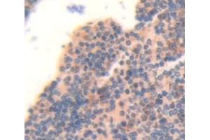 IHC-P analysis of Human Tissue, with DAB staining. (MYL12B 抗体  (AA 5-172))