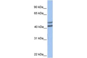 Western Blotting (WB) image for anti-Galactose-1-Phosphate Uridylyltransferase (GALT) antibody (ABIN2463186) (GALT 抗体)