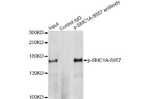 Immunoprecipitation analysis of 200 μg extracts of HeLa cells treated by UV using 2. (SMC1A 抗体  (pSer957))