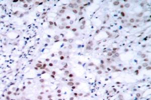 Image no. 2 for anti-Tumor Protein P53 (TP53) antibody (ABIN272050) (p53 抗体)