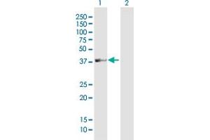 Western Blot analysis of LOC113179 expression in transfected 293T cell line by LOC113179 MaxPab polyclonal antibody. (ADAT3 抗体  (AA 1-351))