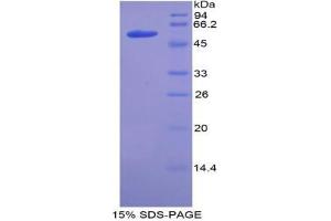 SDS-PAGE analysis of Mouse ACE Protein. (Angiotensin I Converting Enzyme 1 蛋白)