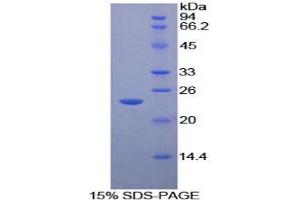 SDS-PAGE analysis of Mouse MST1R Protein. (MST1R 蛋白)