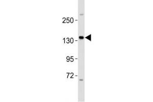 Western blot testing of ERBB4 antibody at 1:2000 dilution + MCF-7 lysate (ERBB4 抗体  (AA 1141-1166))