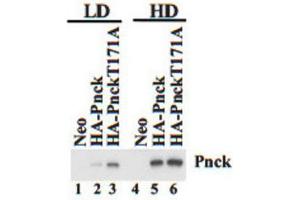 Western Blotting (WB) image for anti-Pregnancy Up-Regulated Non-Ubiquitously Expressed CaM Kinase (PNCK) antibody (ABIN3002987) (PNCK 抗体)