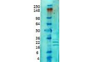 KCHIP Western Blot. (KCNIP1 抗体)