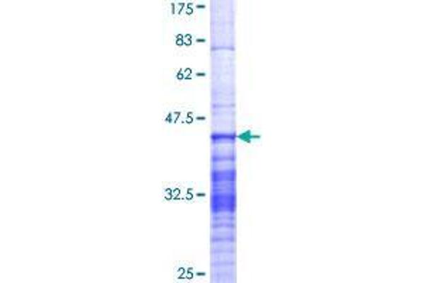 GPSM2 Protein (AA 381-480) (GST tag)