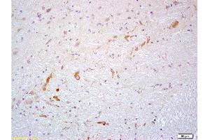 Formalin-fixed and paraffin embedded rat brain labeled with Anti- PROK2/Prokineticin 2 Polyclonal Antibody, Unconjugated  at 1:200 followed by conjugation to the secondary antibody and DAB staining (PROK2 抗体  (AA 28-100))