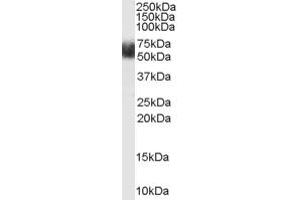 Western Blotting (WB) image for anti-F-Box and Leucine-Rich Repeat Protein 3 (FBXL3) (N-Term) antibody (ABIN2465686) (FBXL3 抗体  (N-Term))