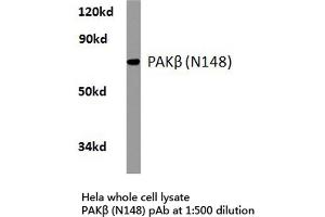 Western blot (WB) analysis of PAKβ antibody in extracts from hela cells. (PAK3 抗体)