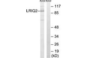 Western Blotting (WB) image for anti-Centrosomal Protein 97kDa (CEP97) (AA 581-630) antibody (ABIN2890391) (CEP97 抗体  (AA 581-630))