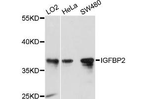 Western blot analysis of extracts of various cell lines, using IGFBP2 antibody (ABIN5970156) at 1/1000 dilution. (IGFBP2 抗体)
