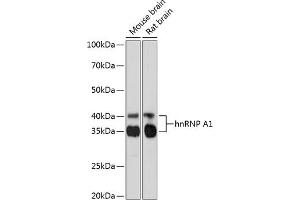 Western blot analysis of extracts of various cell lines, using hnRNP  Rabbit mAb (1564) at 1:1000 dilution. (HNRNPA1 抗体)