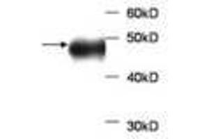 Image no. 1 for anti-Aldolase B, Fructose-Bisphosphate (ALDOB) antibody (ABIN791520) (ALDOB 抗体)