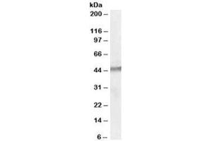 Western blot testing of human testis lysate with STK35 antibody at 1ug/ml. (STK35 抗体)